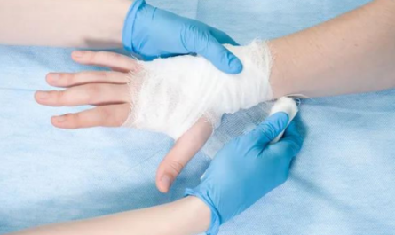 Carpal Tunnel Bandage After Surgery - A Comprehensive Guide