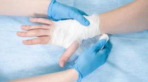 Carpal Tunnel Bandage After Surgery – A Comprehensive Guide