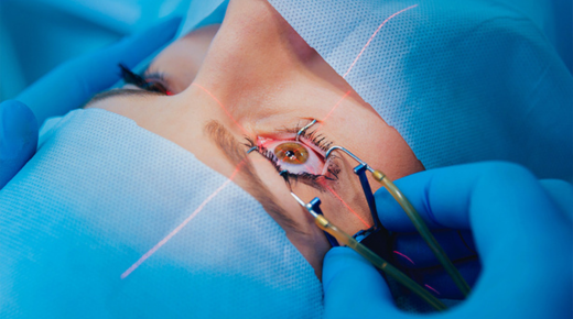 Cataract Surgery Cost in Vasan Eye Care