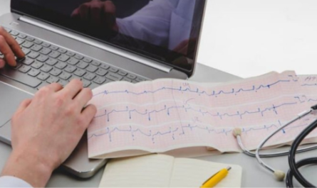 Understanding ICD-10 Coding for Rapid Atrial Fibrillation