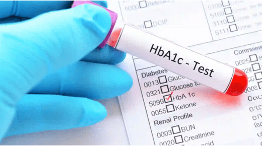 Importance of the HbA1c Test in Diagnosing Diabetes