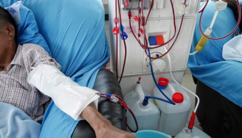 Dialysis in Bangalore – A Complete Guide for Patients