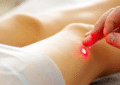 peripheral artery disease treatment
