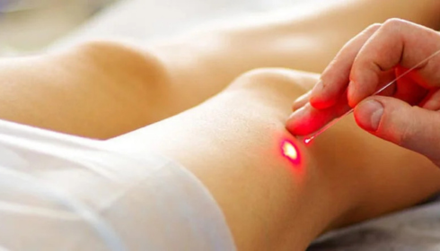 When Circulation Becomes Complicated: A Personal Look at Vascular Health and Healing