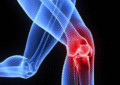orthopaedic Hospital in hyderabad