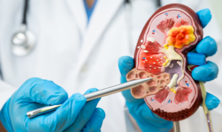 Best kidney transplant hospital in bangalore