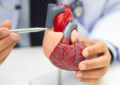 Heart Transplant In Hyderabad