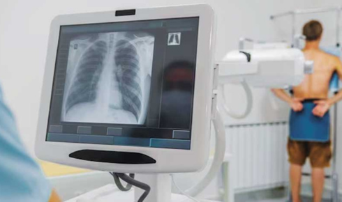 DR System Advancements: Exploring DR 100s Motorised and DR 100e