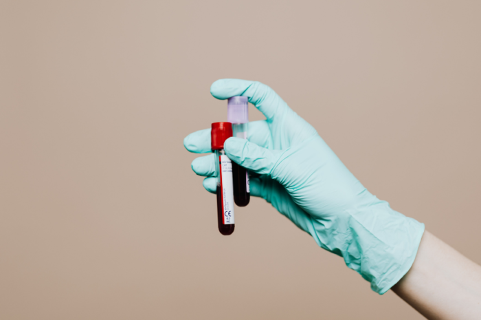 How to prepare for a blood test: a guide before visiting a blood analysis laboratory