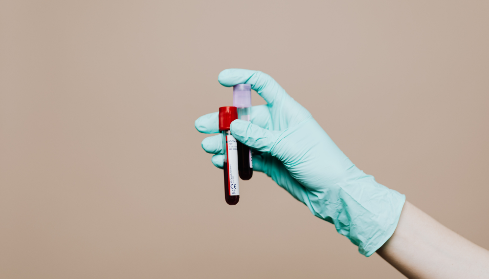 blood analysis lab